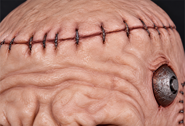 Wound Details