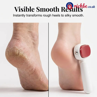 ✨📢LAST DAY SALE: Only ￡6.99!!!🔥Double-Sided Foot Scraper for Callus Removal