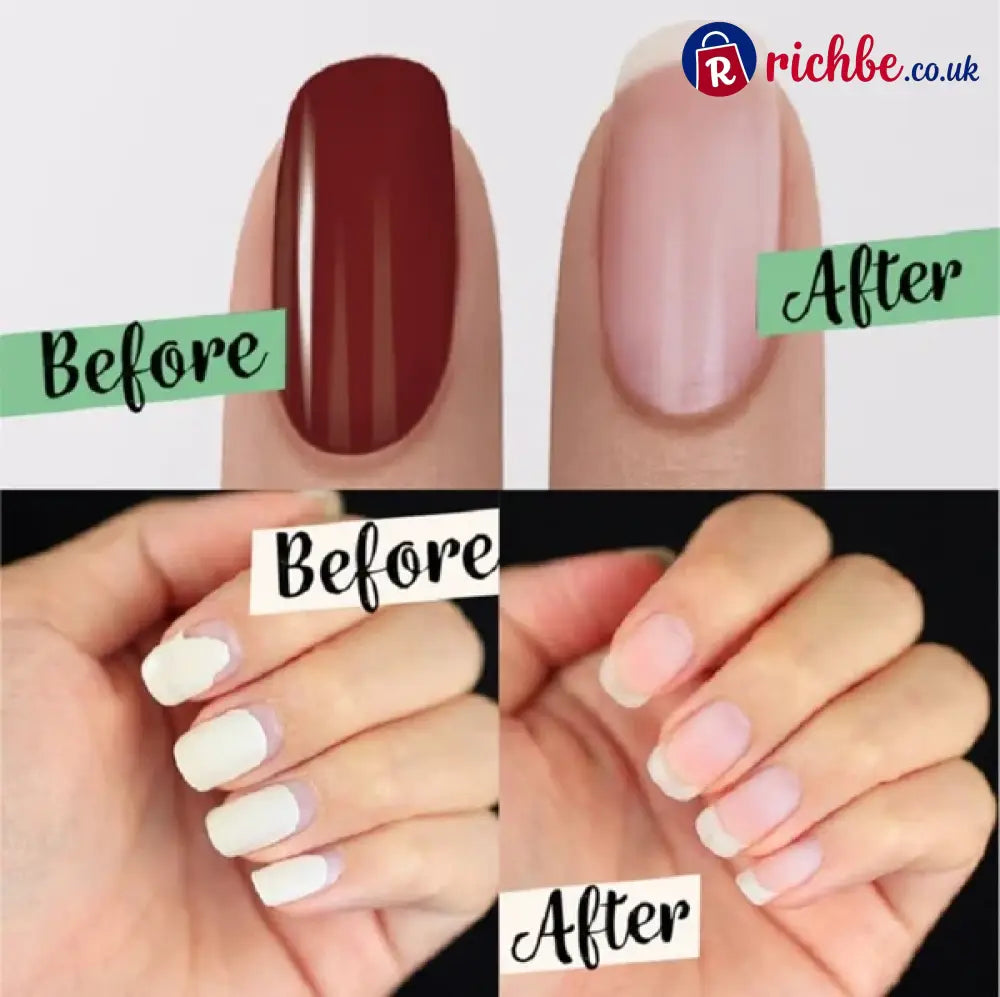 🌿 Buy 1 Get 1 FREE! 🛡️💅Upgraded Magic Nail Polish Remover - Bestseller