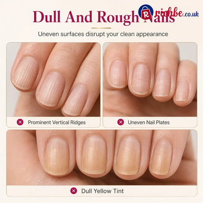 Smooth Nail Ridges Instantly! Natural Ridge Filler - Nail varnish